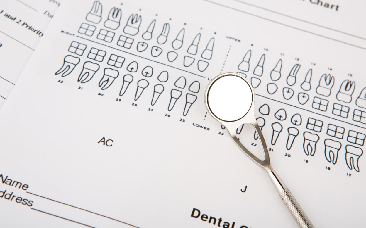 Full-Arch All-on-4 Transformation | Fixed Smile in 4 Months