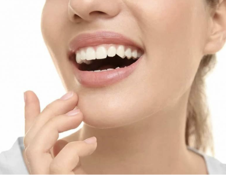 composite bonding dublin